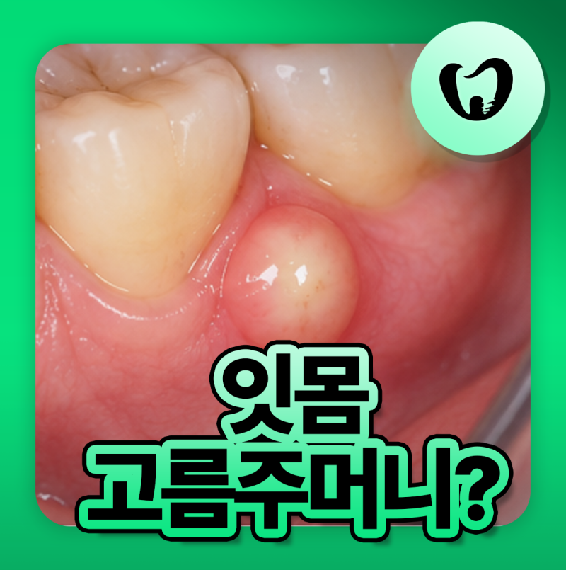 잇몸고름주머니 터짐 배농되면 자연치료 된걸까요?