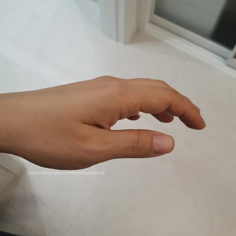 배고플 때 손떨림 왜 그럴까? 저혈당 증상인지 확인해 봤어요