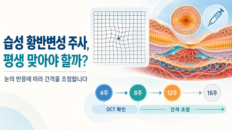 습성 황반변성, 눈에 주사를 계속 맞아야 하나요? 항-VEGF 치료에서 정말 중요한 것