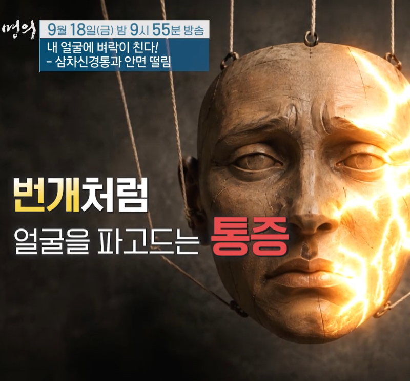 EBS 명의 삼차신경통과 안면 떨림, 얼굴에 벼락 치는 통증과 한쪽 눈떨림 원인은?