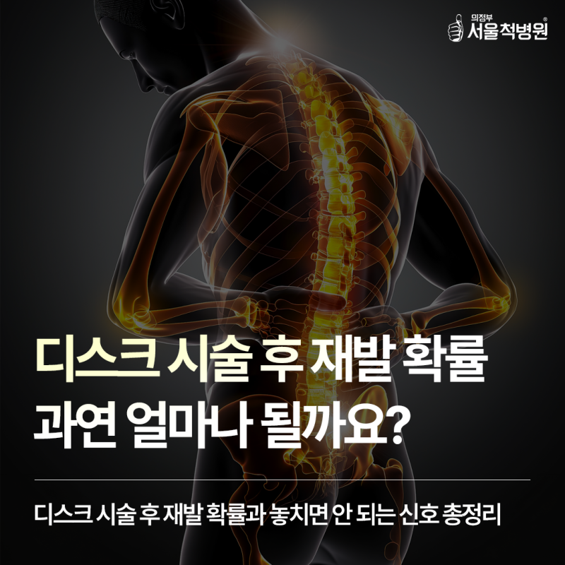 디스크 시술 후 재발 확률 얼마나 될까? 이런 신호 놓치지 마세요!