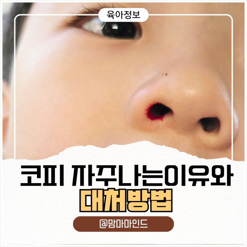아이 코피 자주 나는 이유와 집에서 대처하는 방법｜코피 날 때 올바른 응급처치
