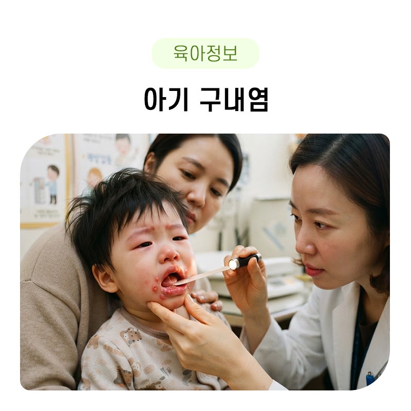 아기 구내염 원인, 증상, 전염에 대해 궁금하면