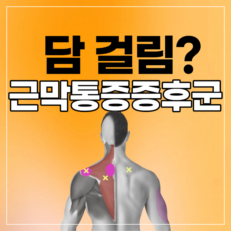 목 어깨 근막통증증후군, 치료 기준 정리
