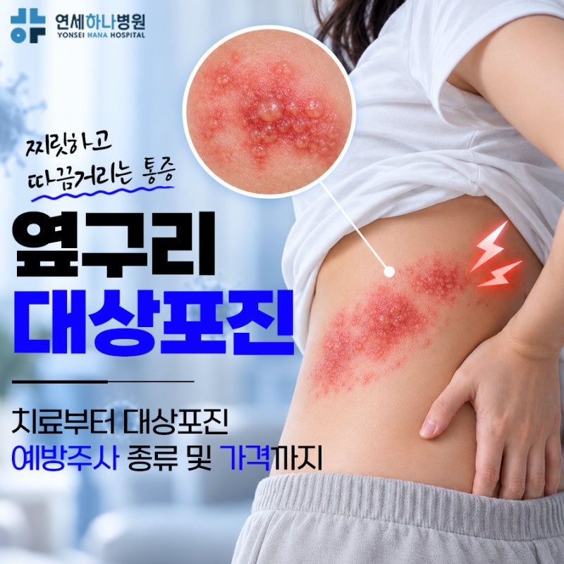 옆구리대상포진 따끔거림, 치료부터 대상포진 예방주사 종류·가격까지