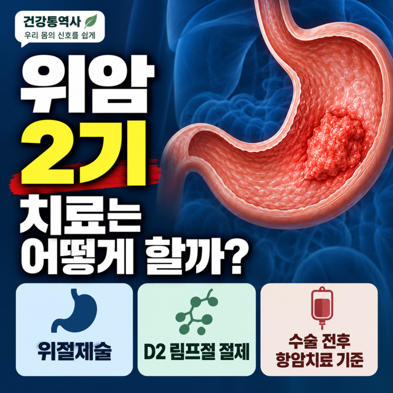 위암 2기 치료는 어떻게 할까? 위절제술·D2 림프절 절제와 수술 전후 항암치료 기준
