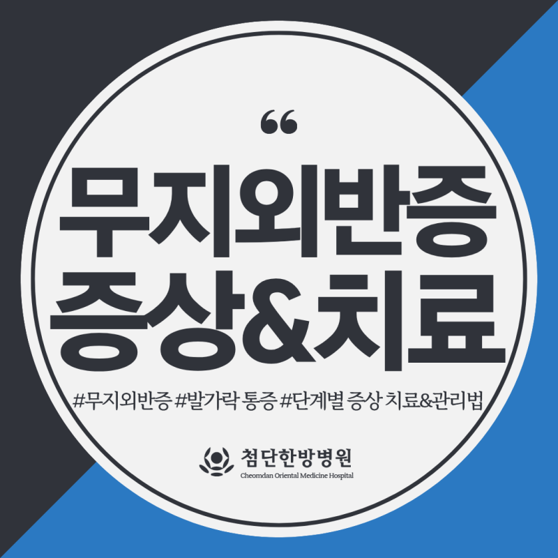 무지외반증, 단계별로 치료 및 관리 방법이 다릅니다(수술이 필요한 경우는?)