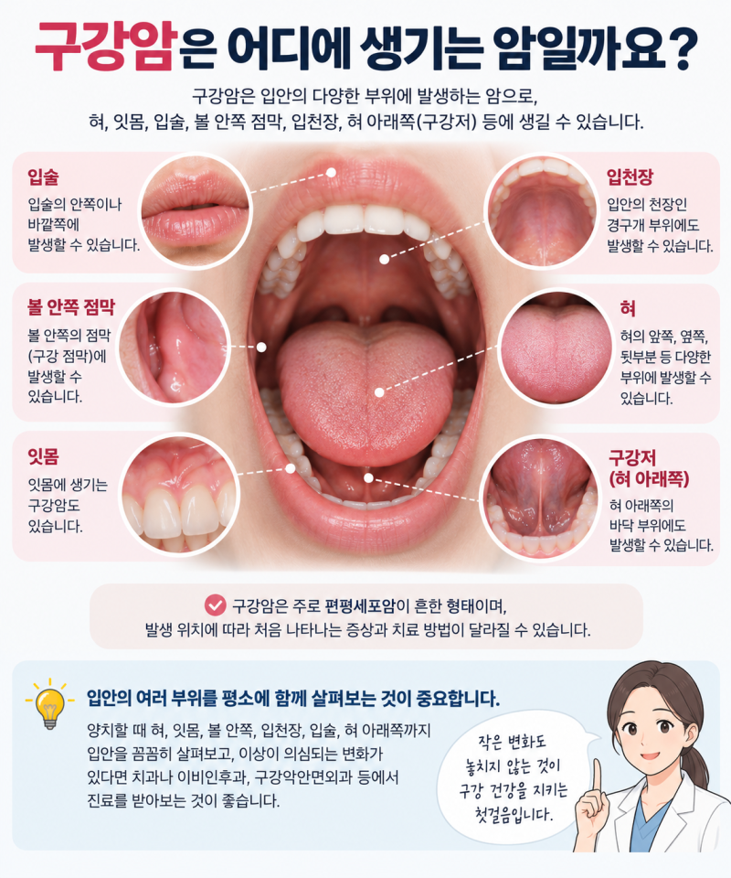 구강암 초기증상은 어떻게 나타날까? 입안에서 확인해야 할 구강암 증상