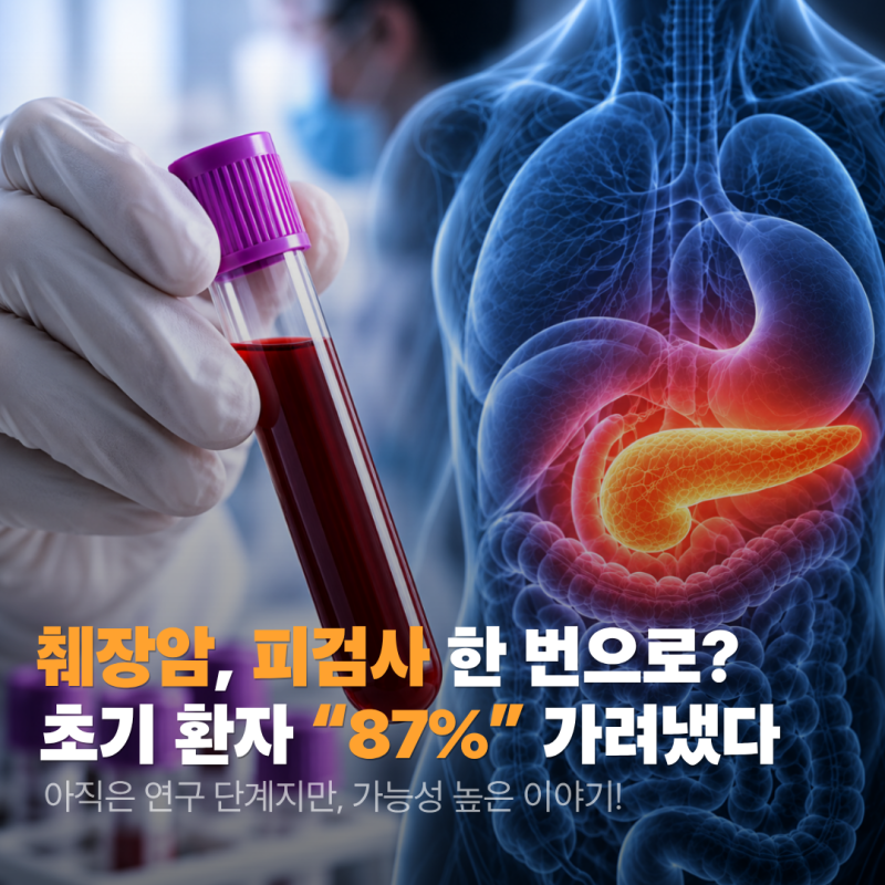 발견이 어려운 췌장암을 피검사 한 번으로 알 수 있다? 한국 참여 실험서 나온 "초기 환자 87% ....