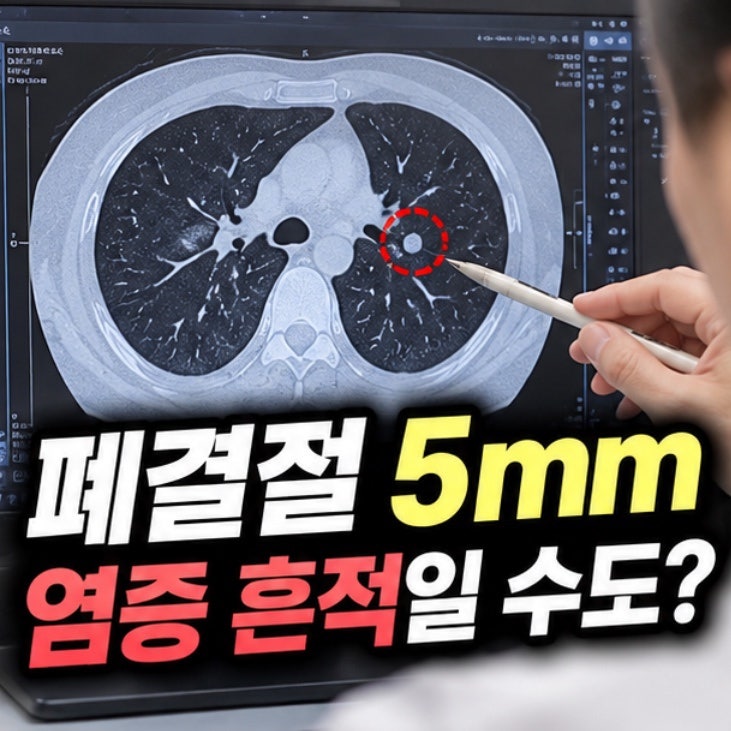 폐결절 5mm 염증 흔적일 수도 있을까? 감기·폐렴 후 발견되는 결절 알아봤어요