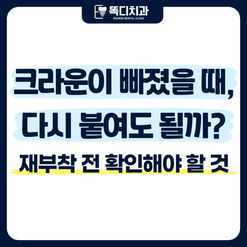 대구 달서구 치과 크라운이 빠졌을 때, 다시 붙여도 될까? 재부착 전 확인해야 할 것