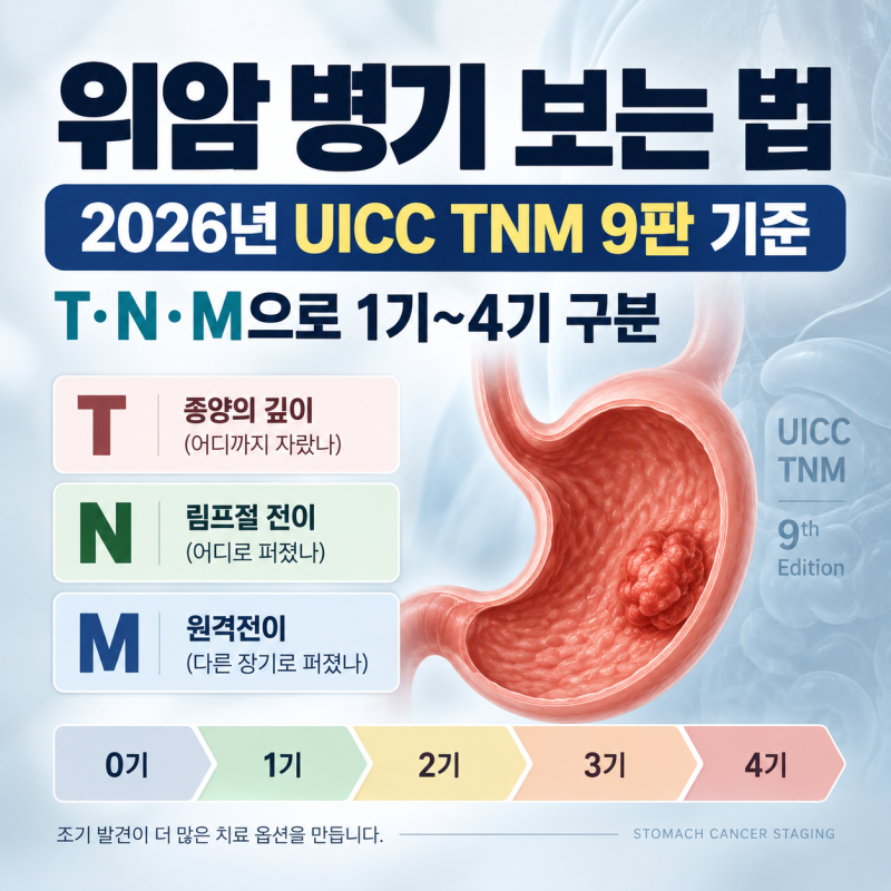 위암 병기 보는 법｜2026년 TNM 기준 T·N·M 뜻과 0기·1기·2기·3기·4기 구분