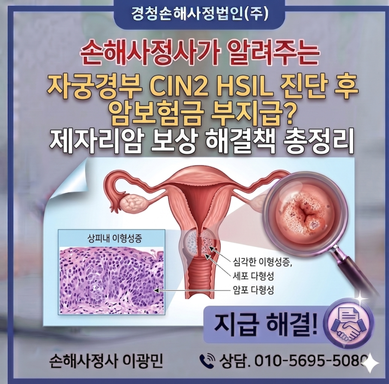 자궁경부 CIN2 HSIL 진단 후 암보험금 부지급? 제자리암 보상 해결책 총정리