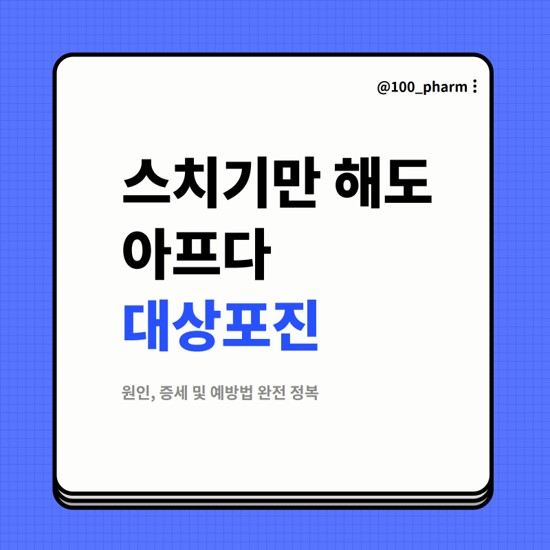 대상포진, 왜 그렇게 무섭다고 할까? 원인/증상/예방접종/치료제