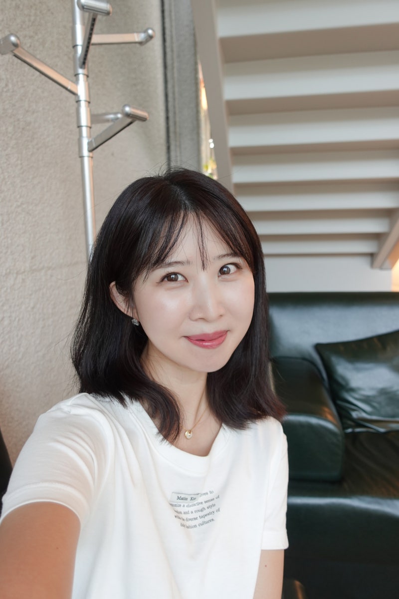 [기미잡티 레이저 피코토닝 제네시스/ 피부과 미백관리 1회차 후기]