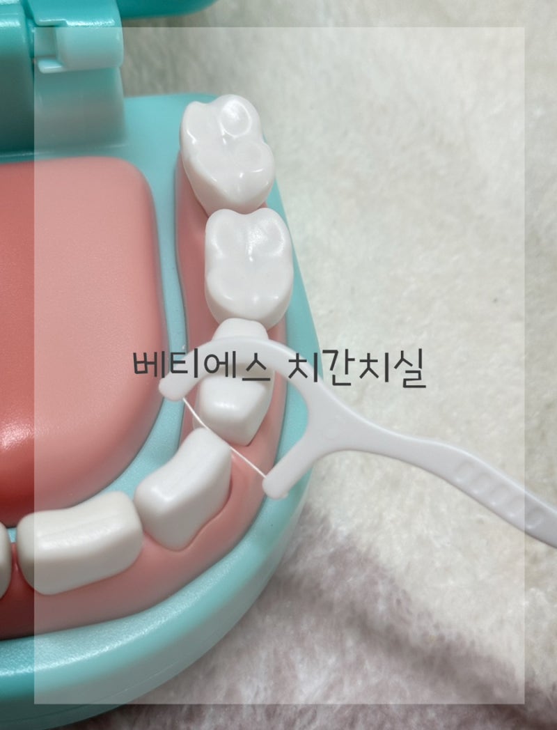 치아 관리의 시작! 치간치실 사용법 베티에스 일회용 치실