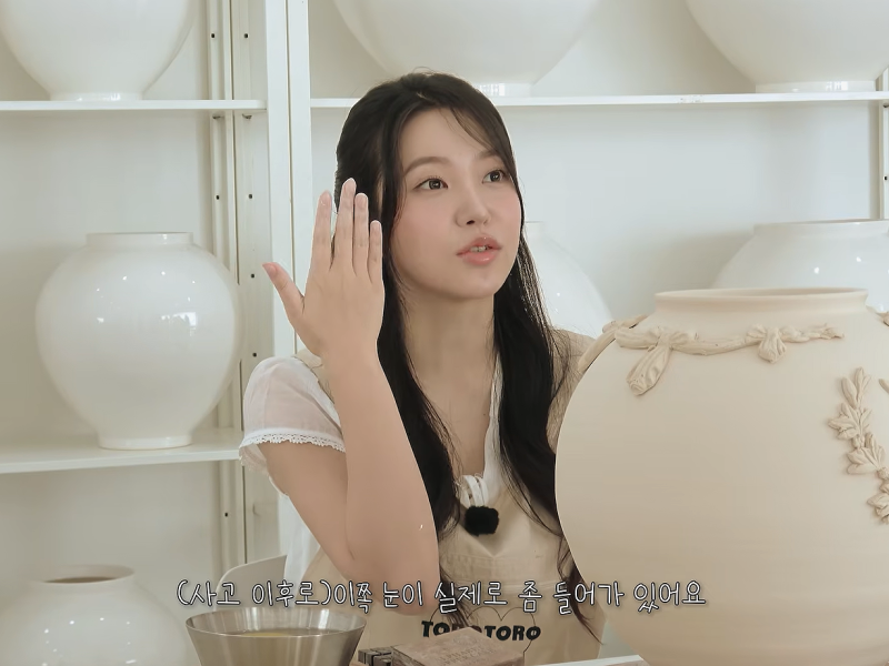 레드벨벳 예리 근황, 10년 만에 밝힌 교통사고 후유증에 다들 놀란 이유