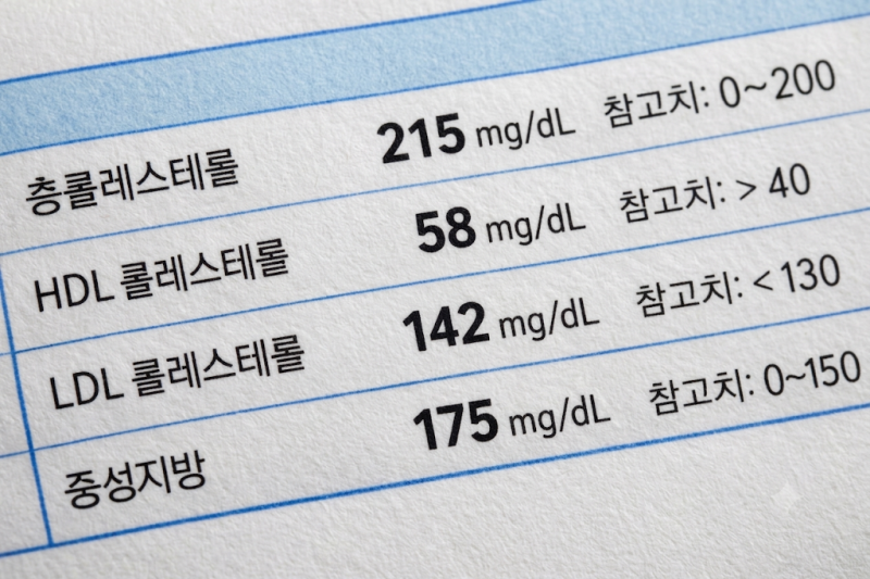 [건강검진 수치] 혈액검사 콜레스테롤(LDL·HDL·중성지방) 정상 범위와 고지혈증 약 복용 기준 ....