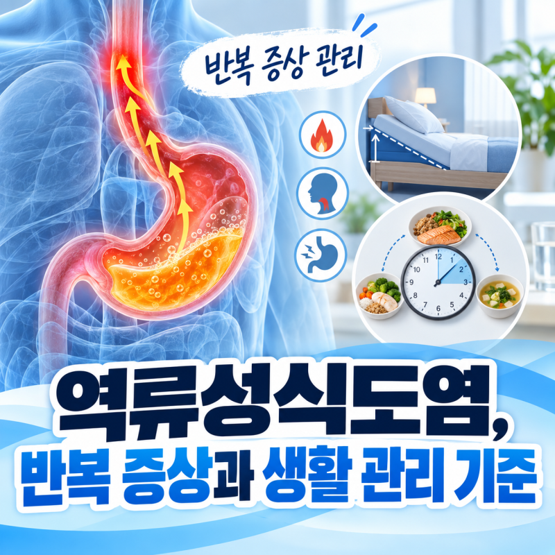 역류성식도염, 반복 증상과 생활 관리 기준