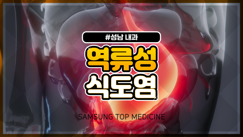 역류성 식도염 재발 막으려면, 평소 생활습관부터 관리해야