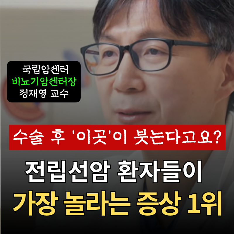 수술 후 '이곳'이 붓는다고요? 전립선암 환자들이 가장 놀라는 증상 1위