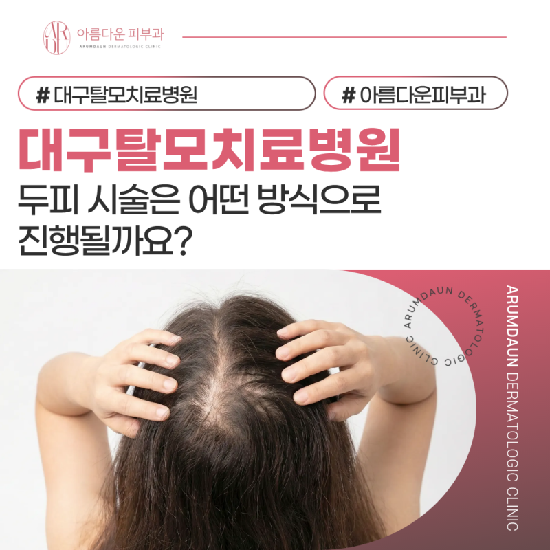 대구탈모치료병원 두피 시술은 어떤 방식으로 진행될까요?