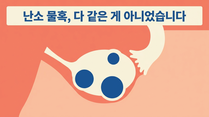 난소물혹 증상, 사실 대부분 없습니다