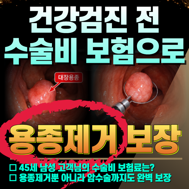건강검진전 꼭 확인해야 할 수술비 보 험, 용종제거도 보장될까?45세 남성고객님의 수술비보....