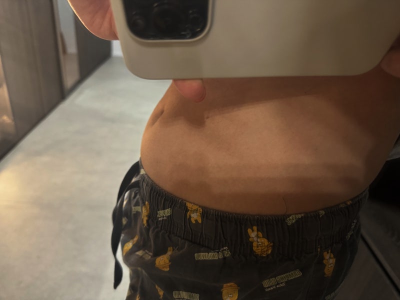 마운자로 위고비 가격 다이어트주사 (52kg 진입) 처방 효과