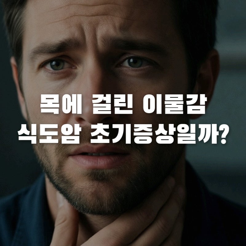 목이물감 원인, 단순 역류성식도염 차이 식도암 초기증상 구별법