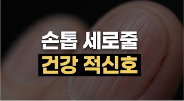 손톱 세로줄이 원인과 우글거림 원인이 생명줄 + 단백질 부족?