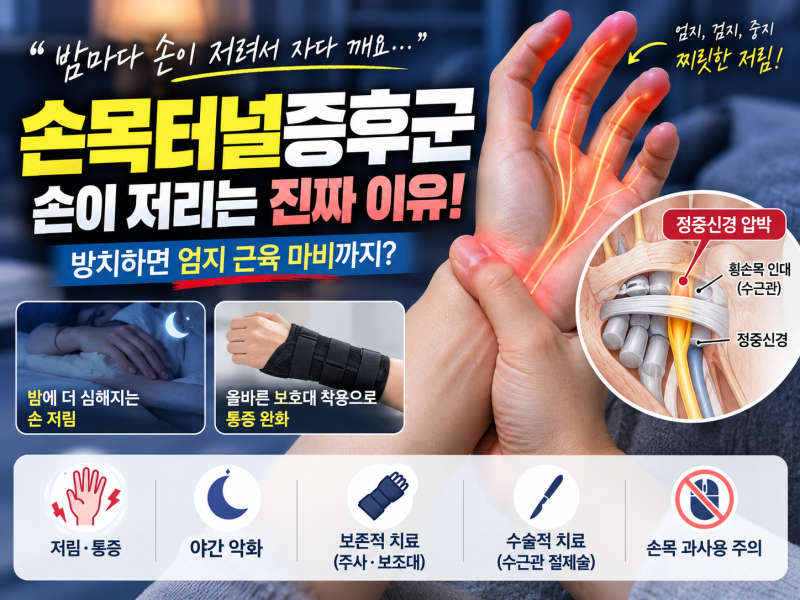 자다가 손이 저려서 깨시나요? 손목 터널 증후군 급성 저림 응급처치 | 정중신경 압박 기전 & ....