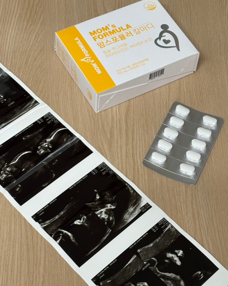 임산부 칼마디 추천 | 맘스포뮬러 뼈건강 영양제 섭취 후기