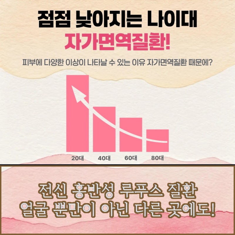 서울 중구 다치지 않았는데 루푸스병초기 증상이 의심된다면?