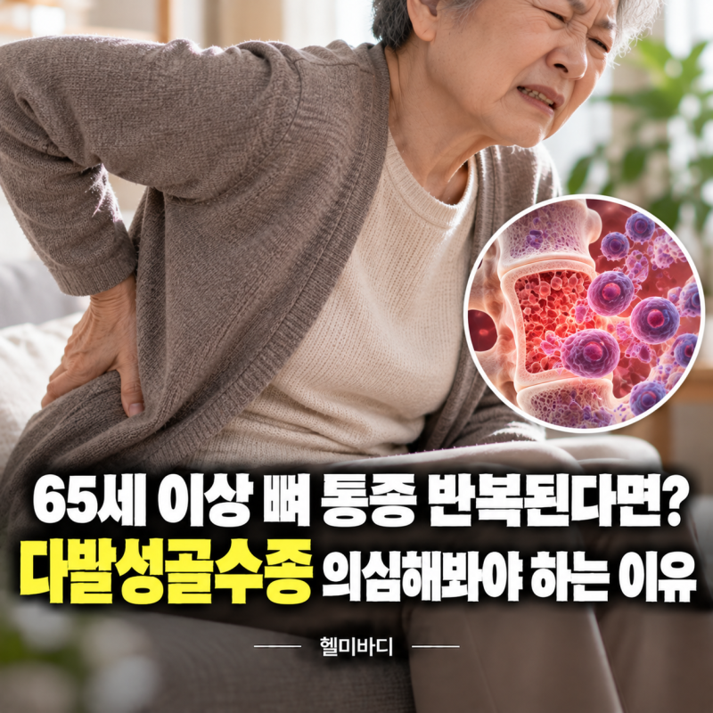65세 이상 뼈 통증 반복된다면? 3대 혈액암 다발성골수종 의심해봐야 하는 이유