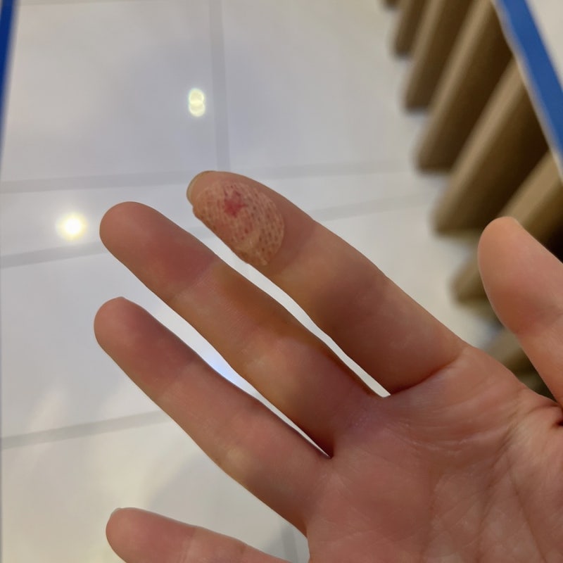 부산 이샘병원 갑상선 세침검사 후기 및 갑상선암 판정까지