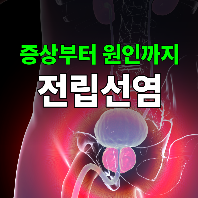 성인 남성 절반이 겪는다는 전립선염증상, 완치가능성까지 심층분석