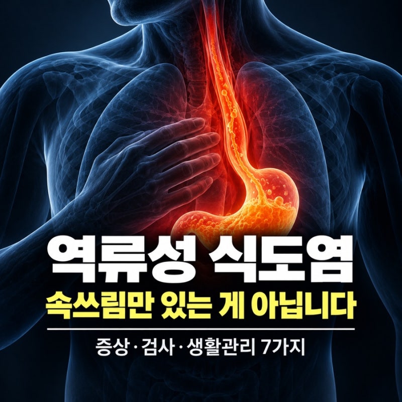 역류성 식도염, 속쓰림만 있는 게 아닙니다｜증상·검사·생활관리 7가지