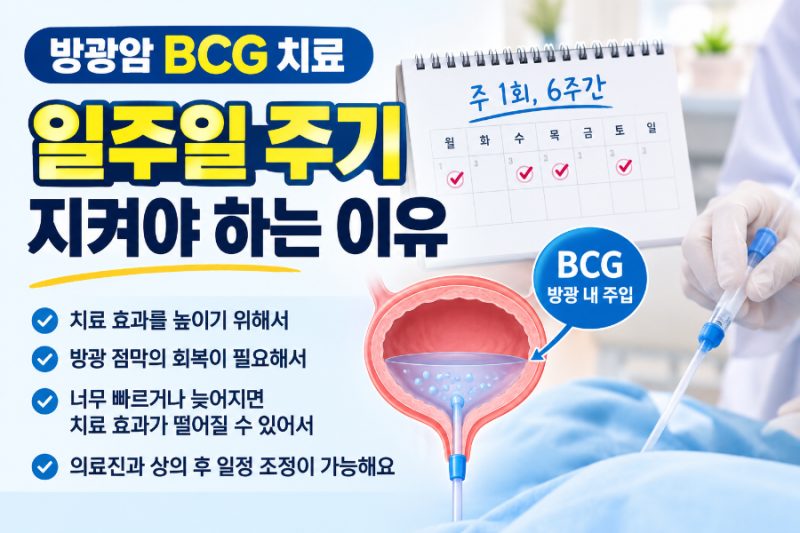 방광암 BCG 치료, 왜 일주일 주기를 지켜야 할까?