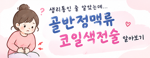 [정보] 골반정맥류가 무엇인지, 시술(코일 색전술) 방법, Q & A 등 모든 것에 대해 알아보아요~