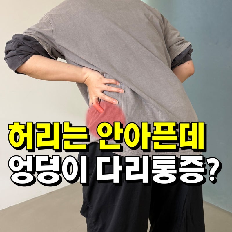 엉덩이에서 다리 뒤쪽까지 저려요 허리디스크 탈출? 좌골신경통 치료