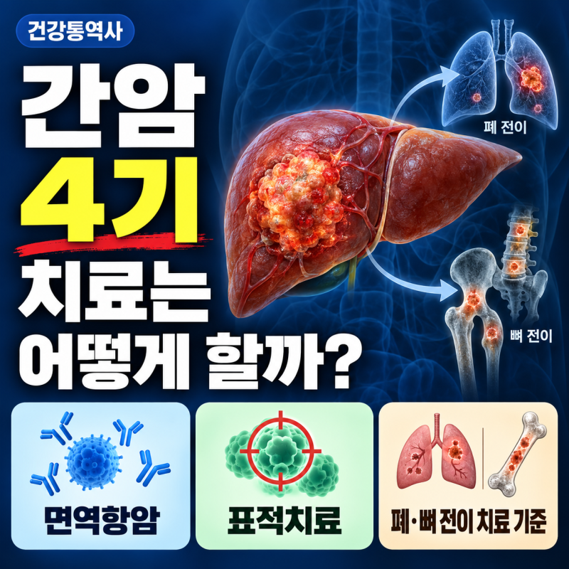 간암 4기 치료는 어떻게 할까? 면역항암·표적치료와 폐·뼈 전이 치료 기준