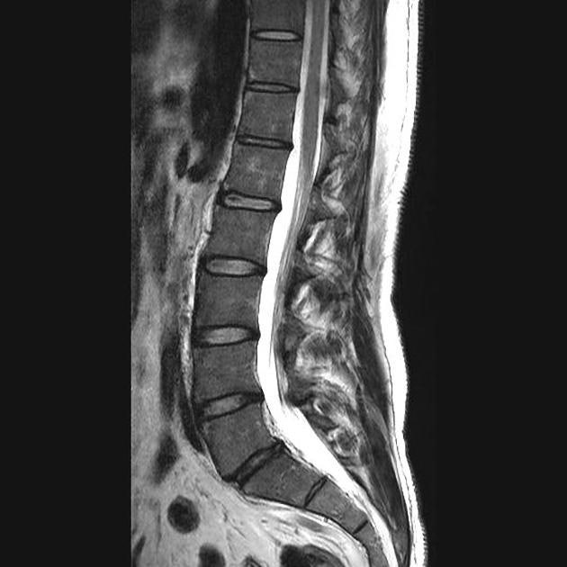 강직성척추염/축성 척추관절염 Ankylosing Spondylitis 의료진·연구자 200명 + 의료기관 200곳을 정....