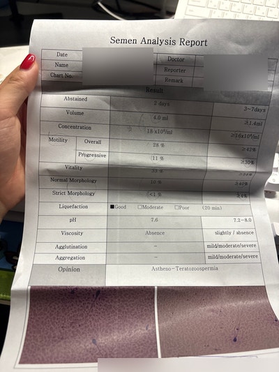 [임신준비] 남자 정자정밀형태검사 재검 후기｜8개월 뒤 수치 변화(영양제/주의사항 등)
