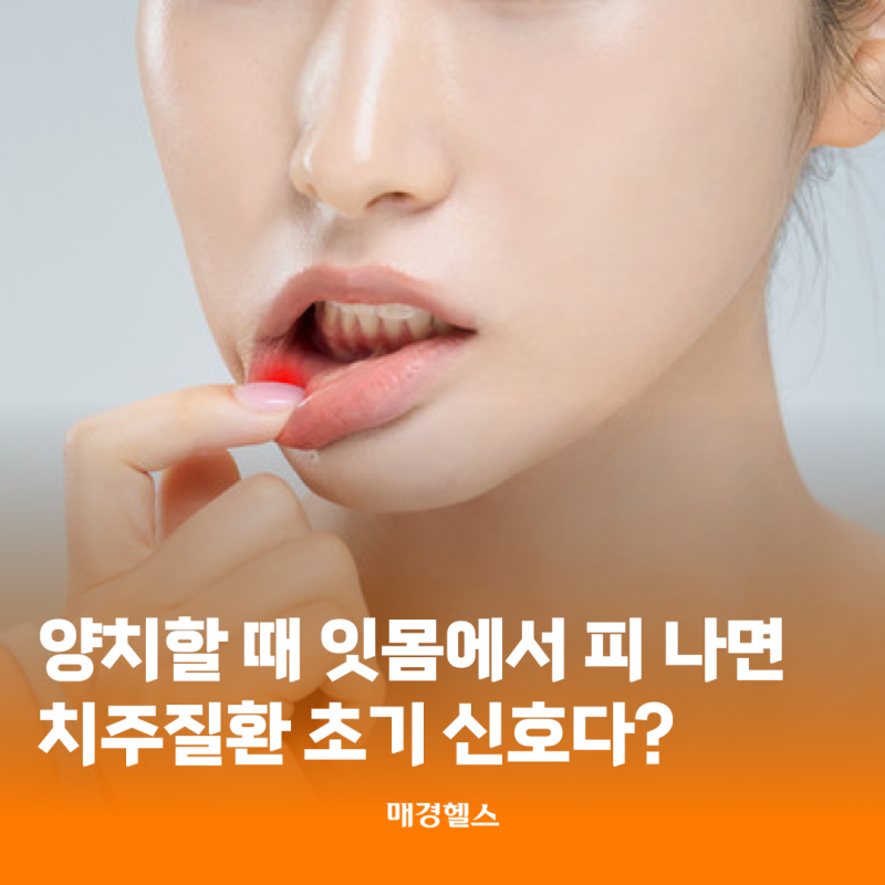 양치할 때 잇몸에서 피나면 치주질환 초기 신호다?