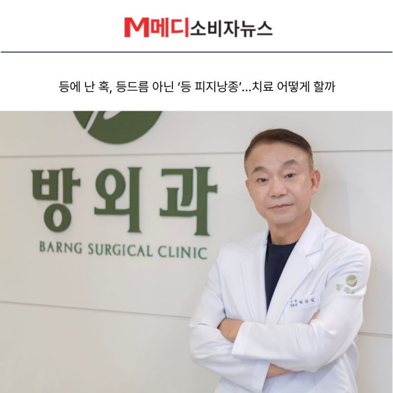 등에 난 혹, 등드름 아닌 ‘등 피지낭종’…치료 어떻게 할까 [언론보도]