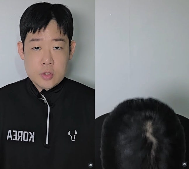 “술집 난동 공채 개그맨 저 아닙니다” 박종욱, 범인으로 오해받자 직접 해명한 이유