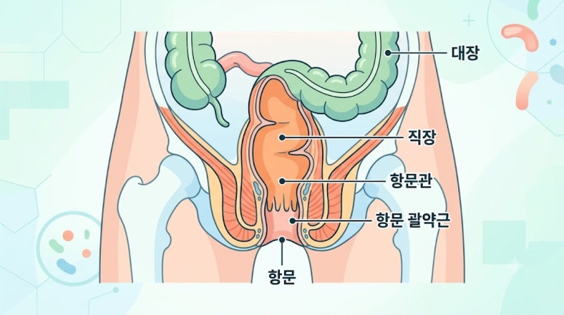 항문 통증과 피 고름 치질 치열 치루 농양 차이점 완벽 정리