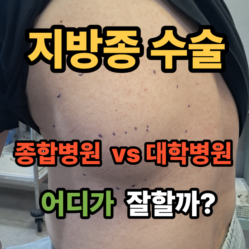 지방종 수술, 종합병원 vs 대학병원 어디가 잘할까?