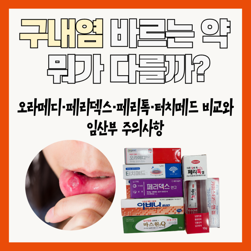 구내염 바르는 약 뭐가 다를까? 오라메디·페리덱스·페리톡·터치메드 비교와 임산부 주의사....